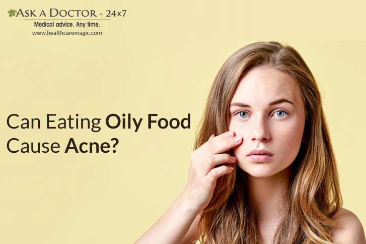 Truth or Myth: Eating Oily Food Cause Acne Breakout!