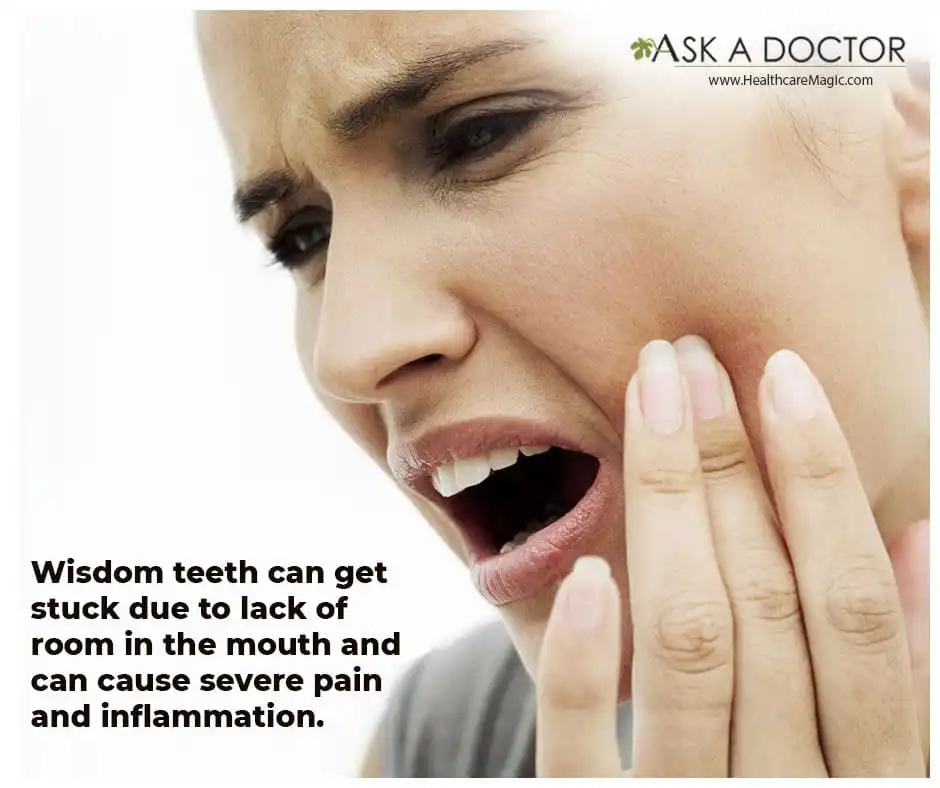 Things You Need to Know About Wisdom Tooth Pain and Remedies to Get Relief!
