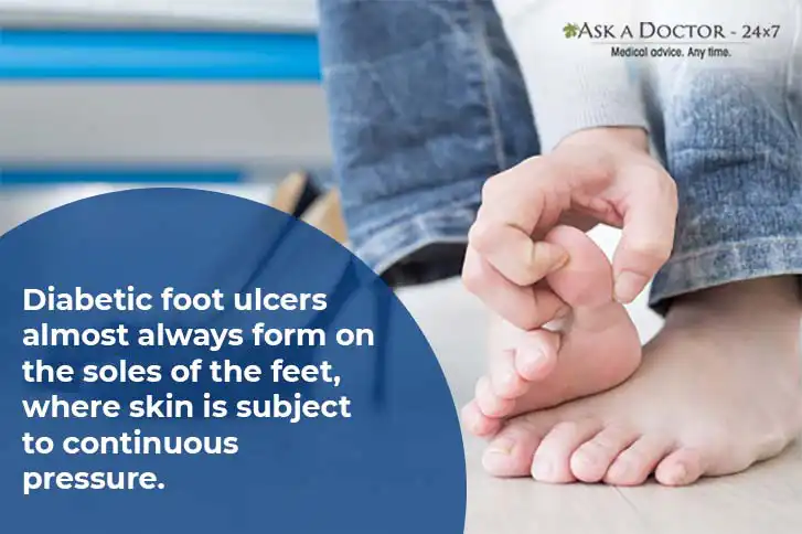 Diabetic Foot Ulcers: Why You Should Never Ignore Them, and Remedies to Heal Them