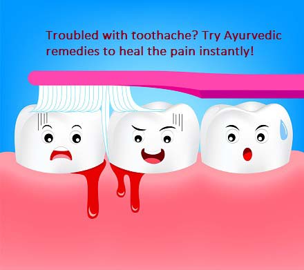 6 Ayurvedic Remedies To Tackle Toothache Naturally