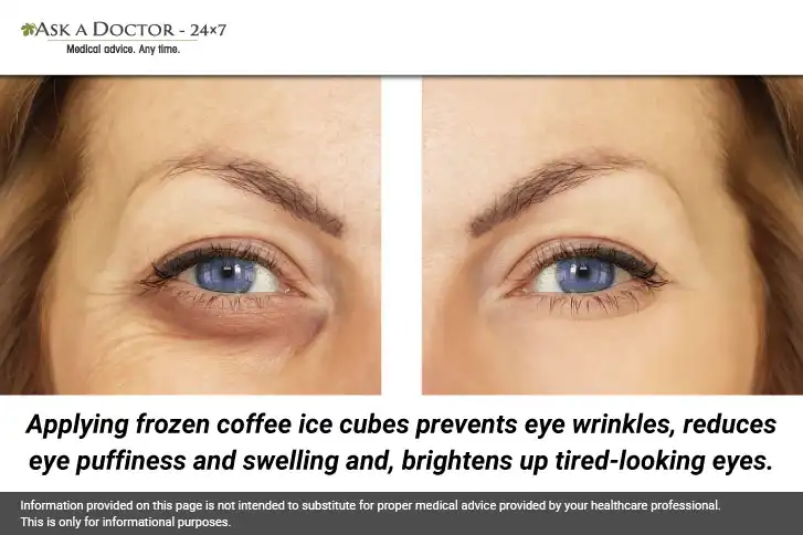7 Natural DIY Masks to Scavenge Your Under-Eye Wrinkles