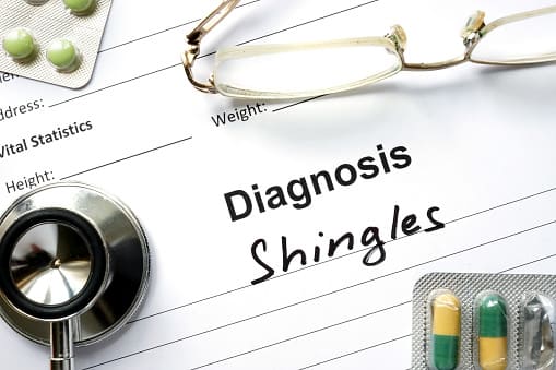 shingles mentioned on the diagnosis paper